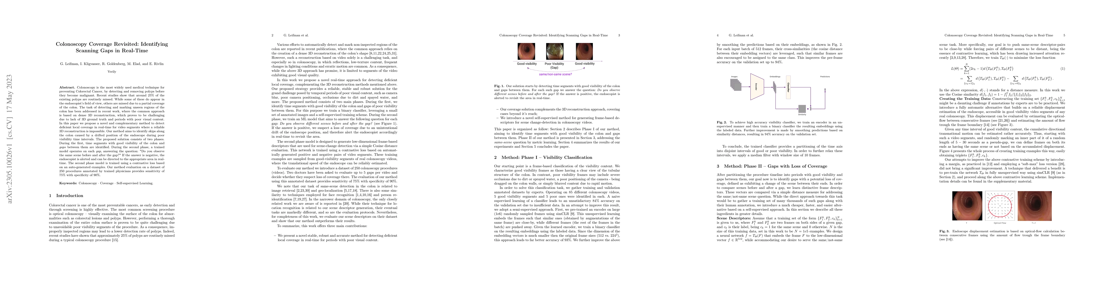 Thumbnail for Colonoscopy Coverage Revisited: Identifying Scanning Gaps in Real-Time