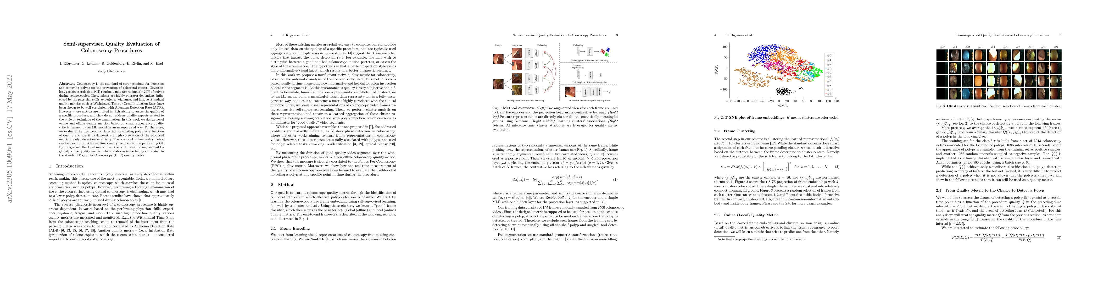 Thumbnail for Semi-supervised Quality Evaluation of Colonoscopy Procedures