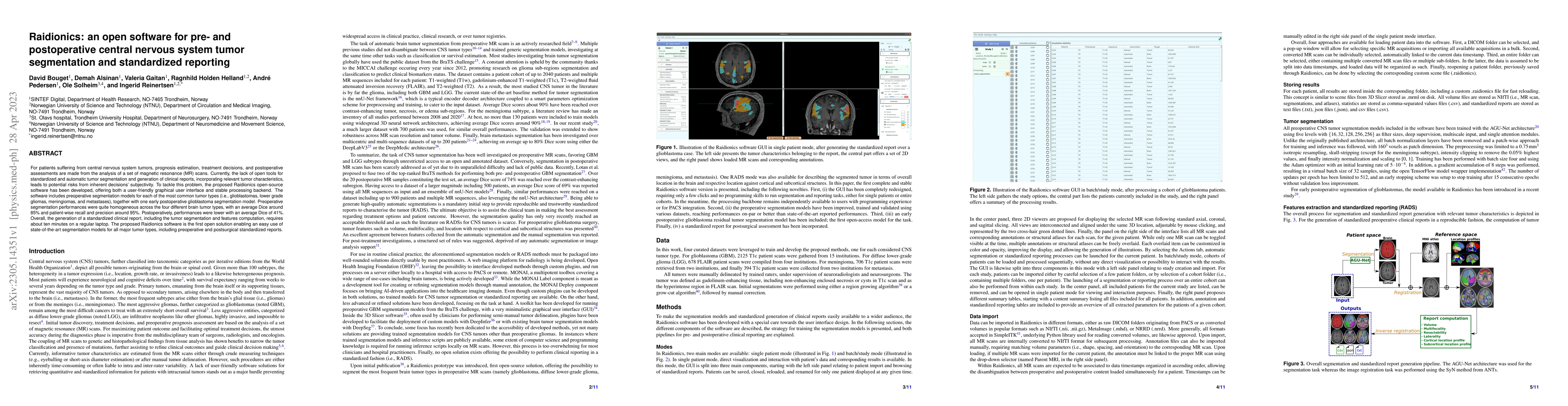 Thumbnail for Raidionics: an open software for pre- and postoperative central nervous
  system tumor segmentation and standardized reporting