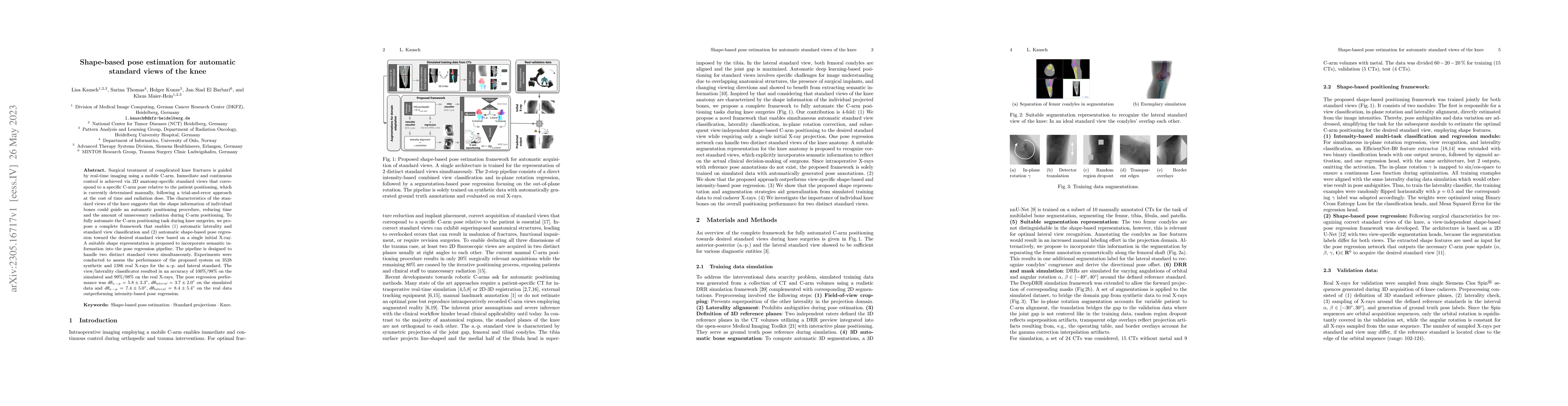 Thumbnail for Shape-based pose estimation for automatic standard views of the knee