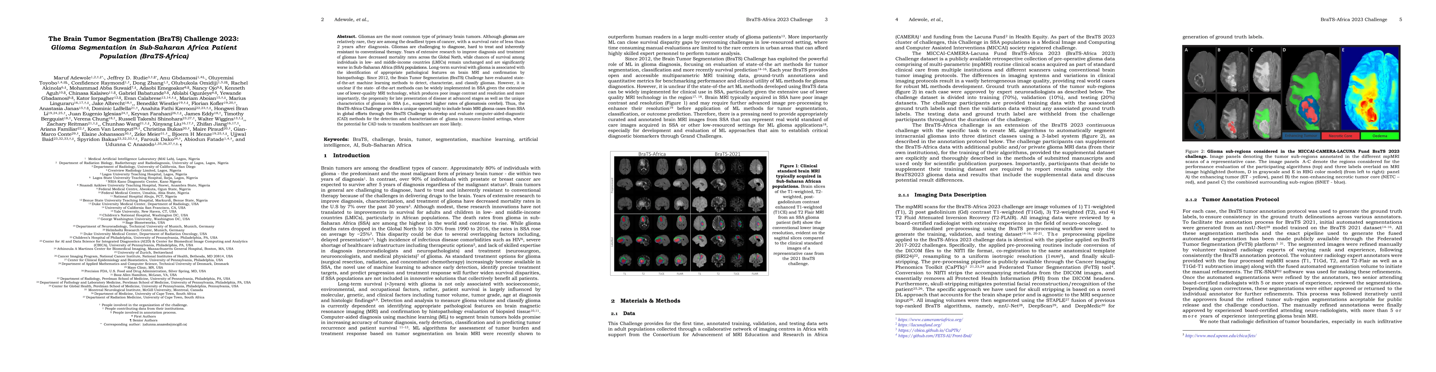 Thumbnail for The Brain Tumor Segmentation (BraTS) Challenge 2023: Glioma Segmentation
  in Sub-Saharan Africa Patient Population (BraTS-Africa)