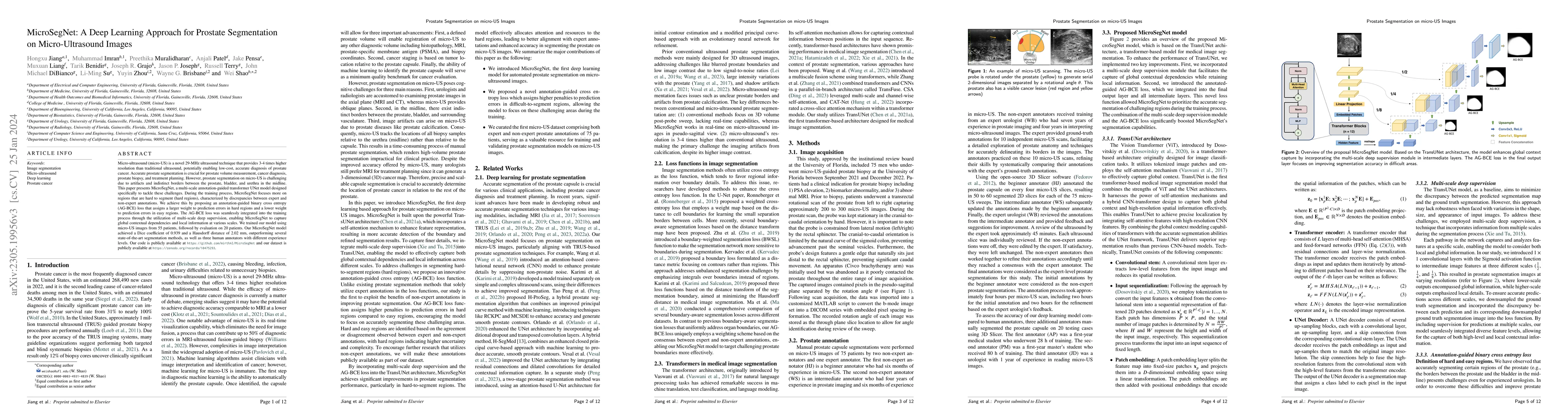 Thumbnail for MicroSegNet: A Deep Learning Approach for Prostate Segmentation on
  Micro-Ultrasound Images