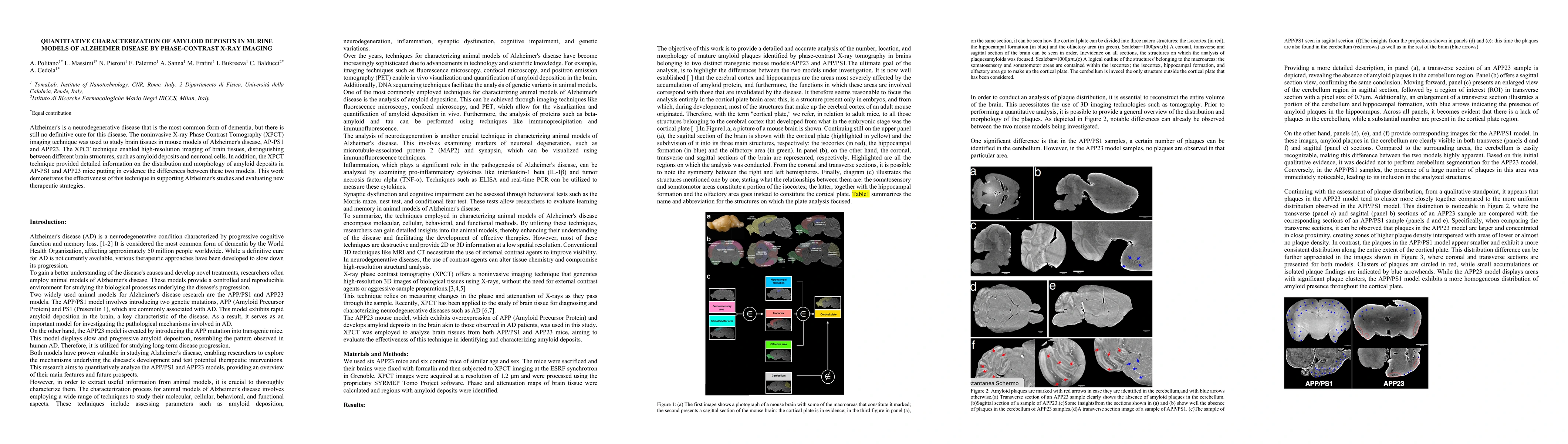 Thumbnail for Quantitative characterization of amyloid deposits in murine models of
  alzheimer disease by phase-contrast x-ray imaging