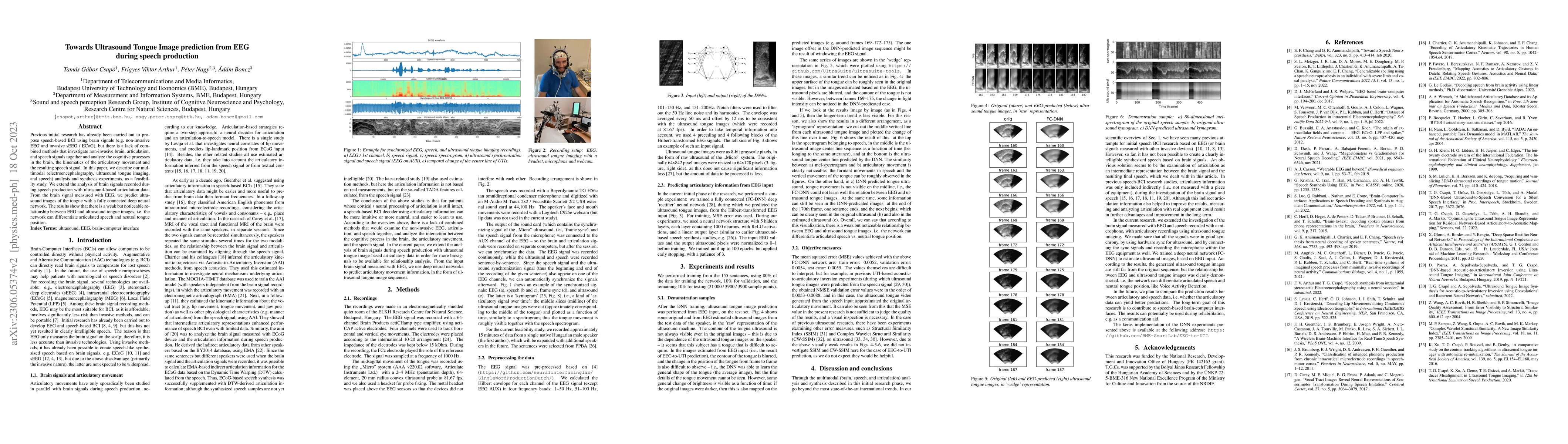 Thumbnail for Towards Ultrasound Tongue Image prediction from EEG during speech
  production
