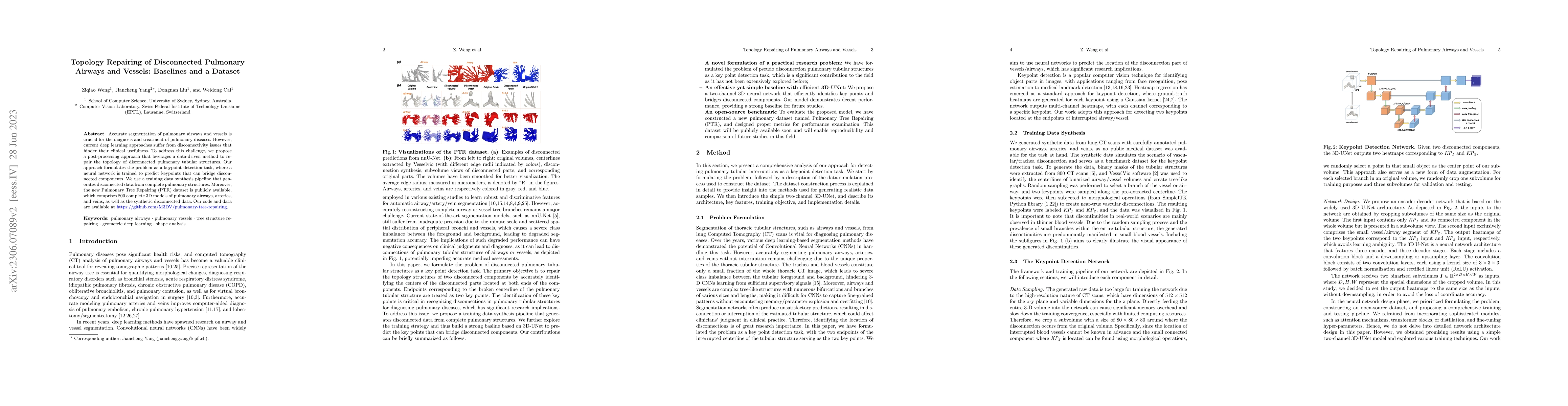 Thumbnail for Topology Repairing of Disconnected Pulmonary Airways and Vessels:
  Baselines and a Dataset