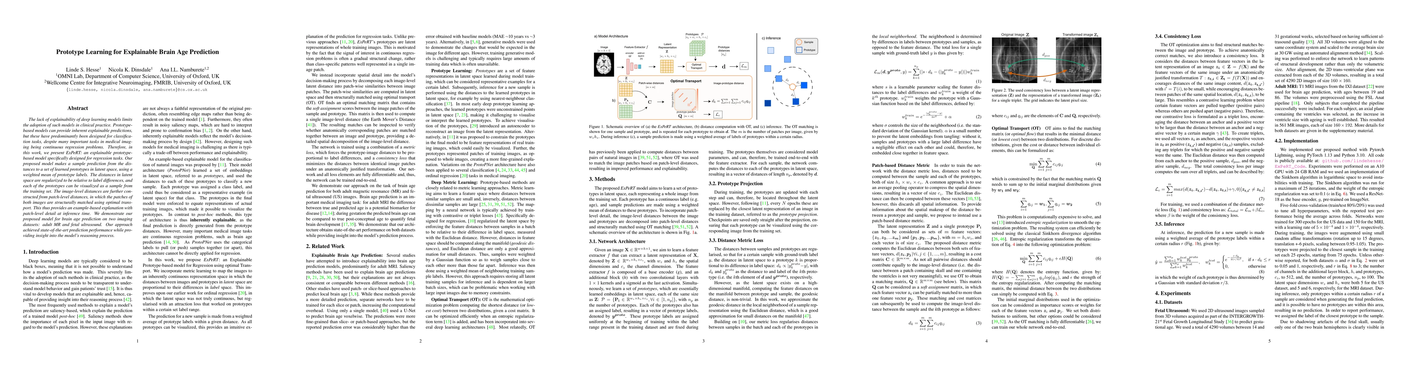 Thumbnail for Prototype Learning for Explainable Brain Age Prediction