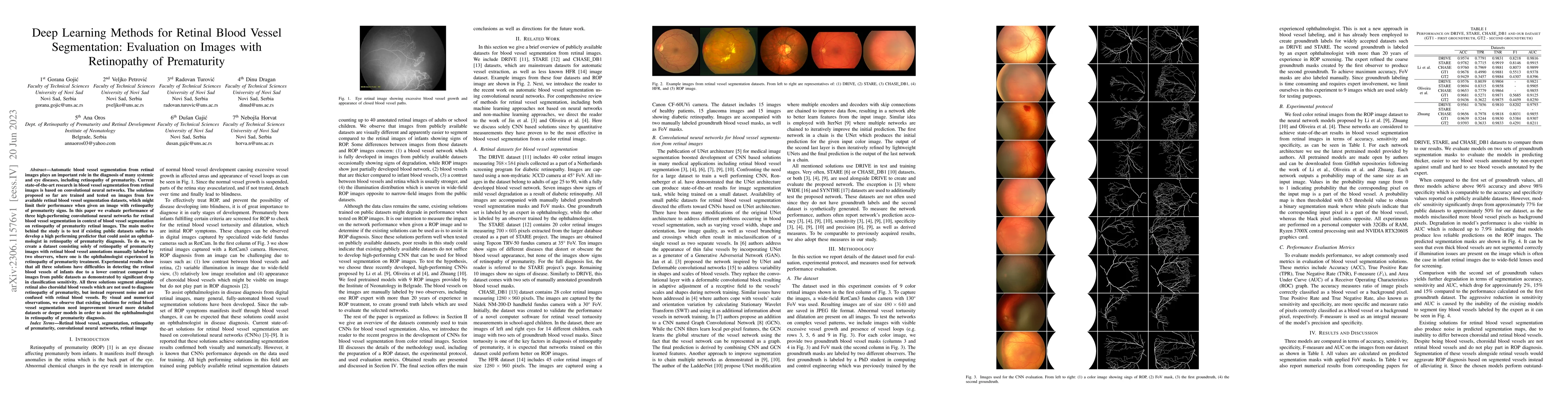 Thumbnail for Deep Learning Methods for Retinal Blood Vessel Segmentation: Evaluation
  on Images with Retinopathy of Prematurity