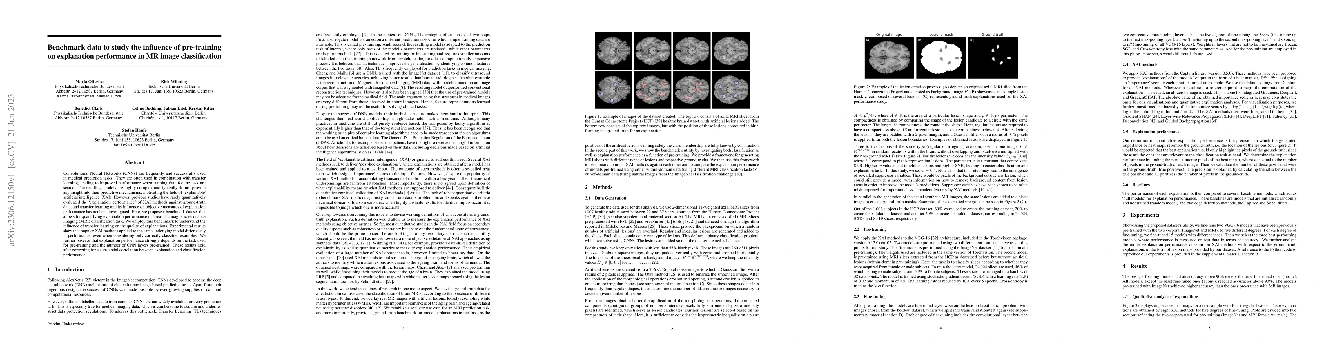 Thumbnail for Benchmark data to study the influence of pre-training on explanation
  performance in MR image classification