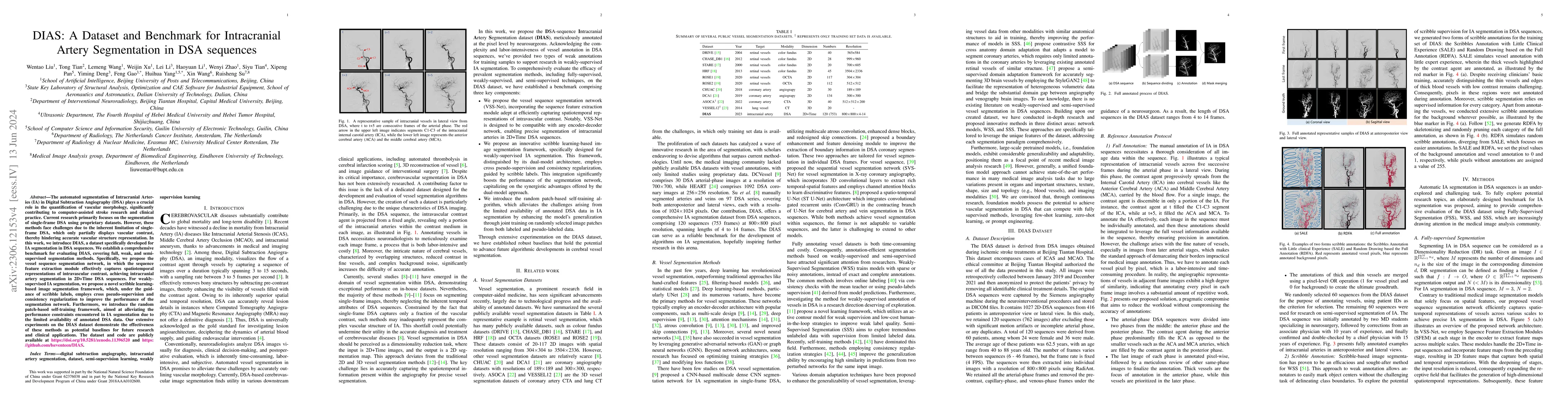 Thumbnail for DIAS: A Dataset and Benchmark for Intracranial Artery Segmentation in
  DSA sequences