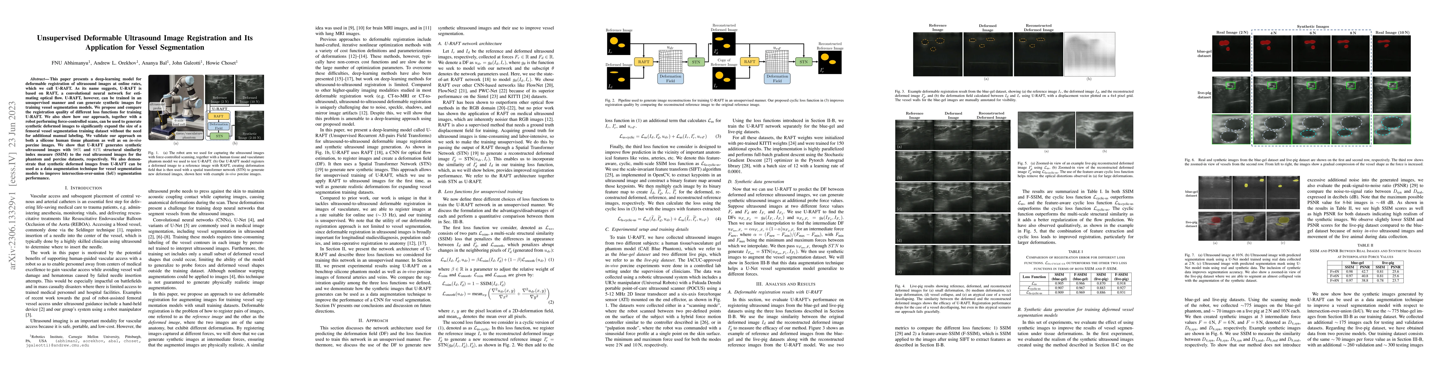 Thumbnail for Unsupervised Deformable Ultrasound Image Registration and Its
  Application for Vessel Segmentation