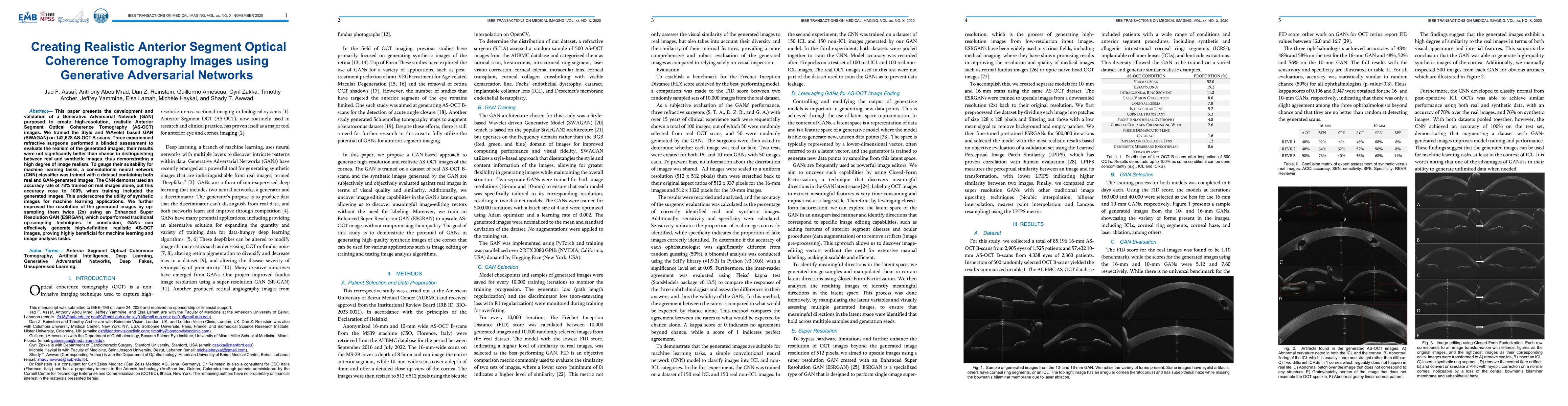 Thumbnail for Creating Realistic Anterior Segment Optical Coherence Tomography Images
  using Generative Adversarial Networks