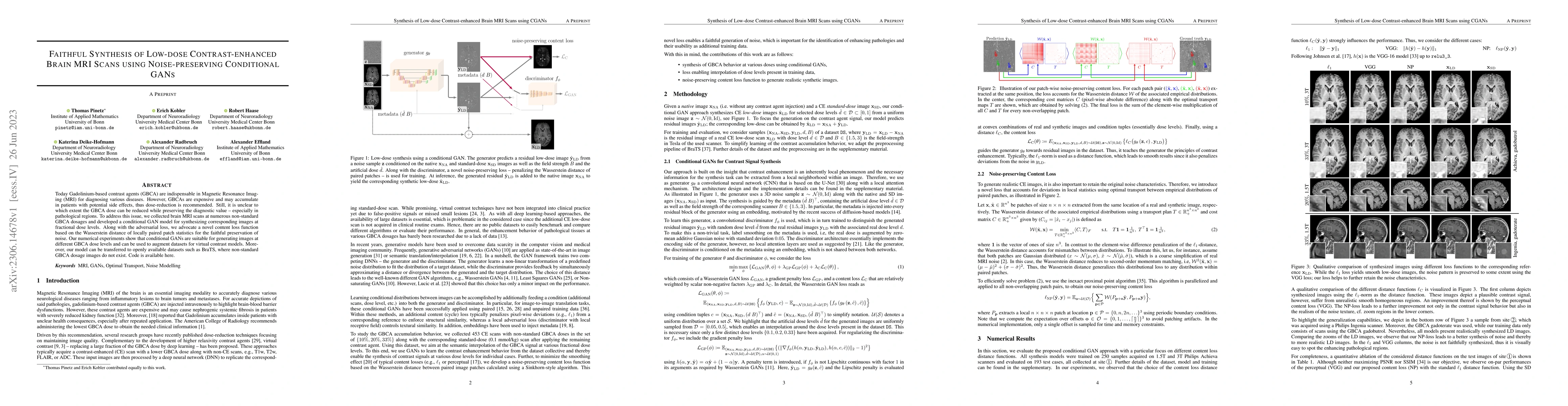 Thumbnail for Faithful Synthesis of Low-dose Contrast-enhanced Brain MRI Scans using
  Noise-preserving Conditional GANs