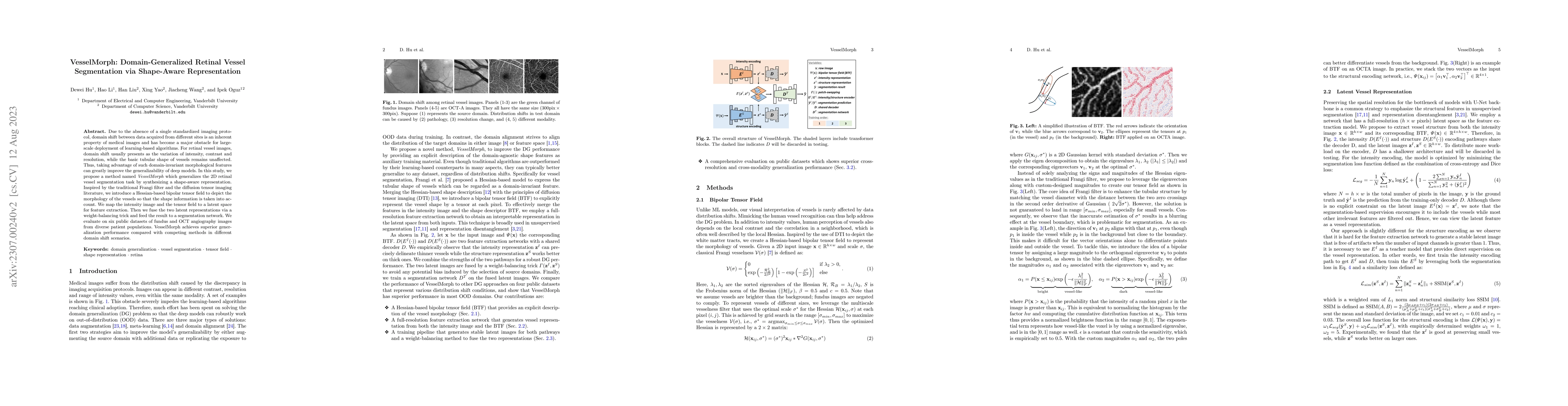 Thumbnail for VesselMorph: Domain-Generalized Retinal Vessel Segmentation via
  Shape-Aware Representation