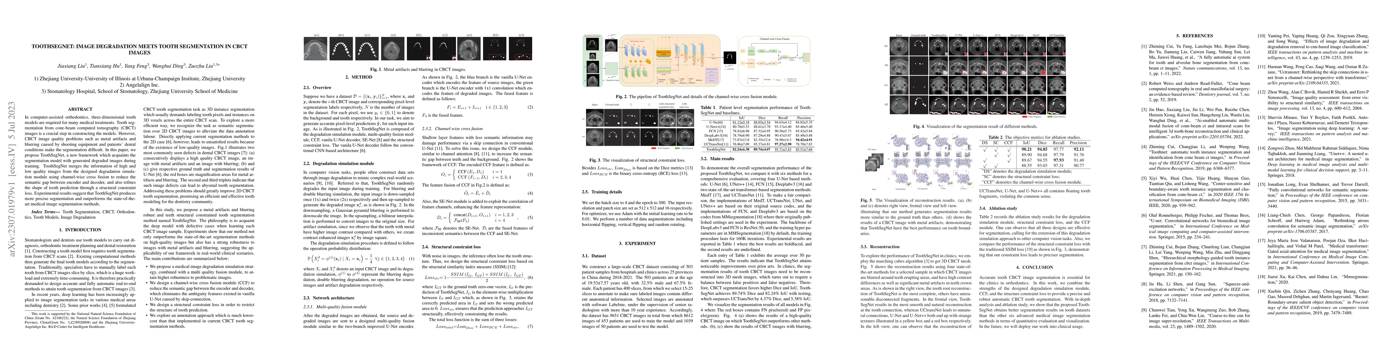 Thumbnail for ToothSegNet: Image Degradation meets Tooth Segmentation in CBCT Images