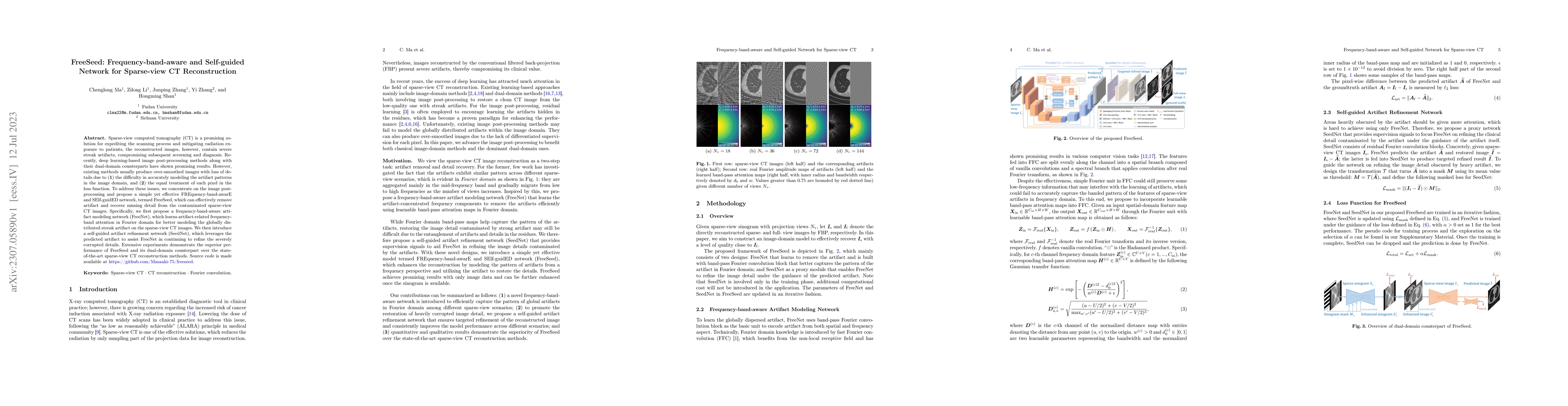 Thumbnail for FreeSeed: Frequency-band-aware and Self-guided Network for Sparse-view
  CT Reconstruction