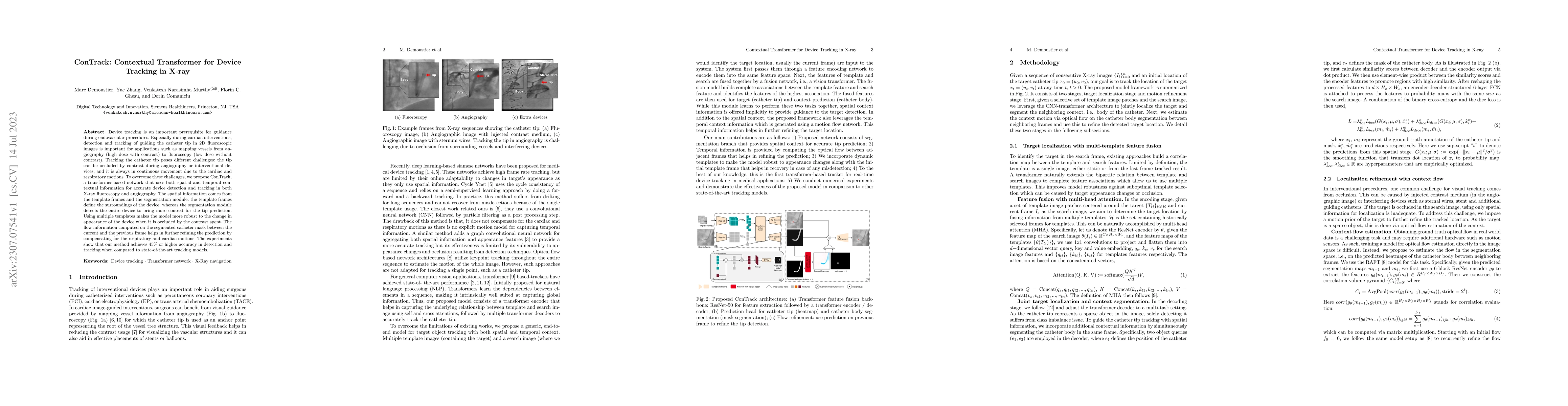 Thumbnail for ConTrack: Contextual Transformer for Device Tracking in X-ray
