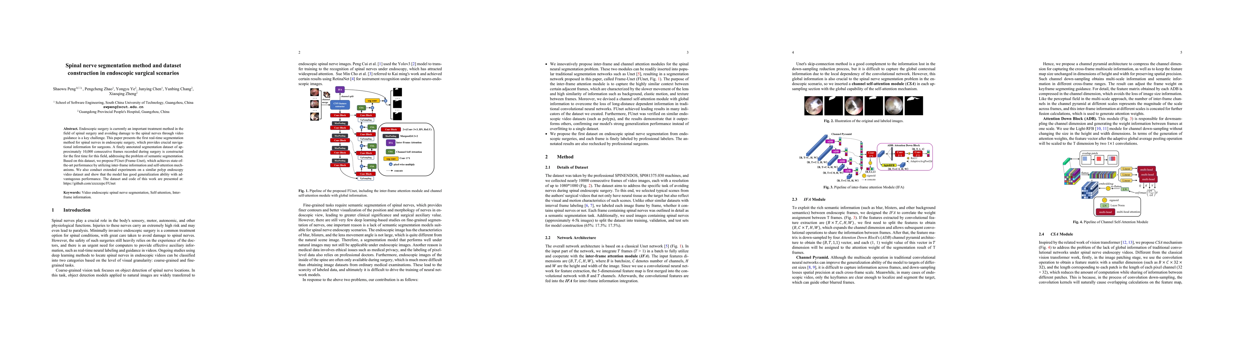 Thumbnail for Spinal nerve segmentation method and dataset construction in endoscopic
  surgical scenarios