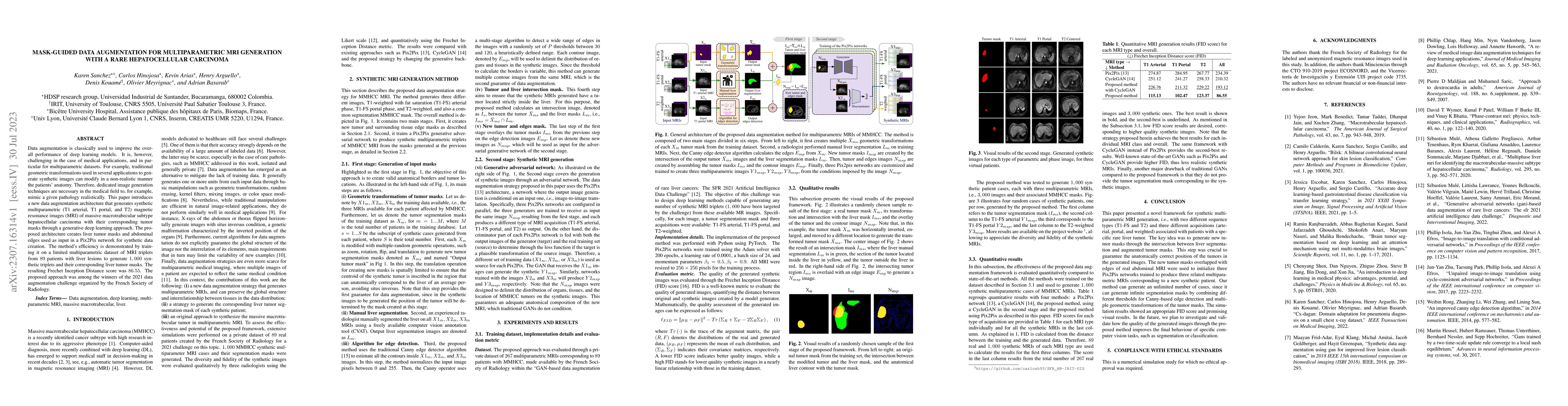 Thumbnail for Mask-guided Data Augmentation for Multiparametric MRI Generation with a
  Rare Hepatocellular Carcinoma