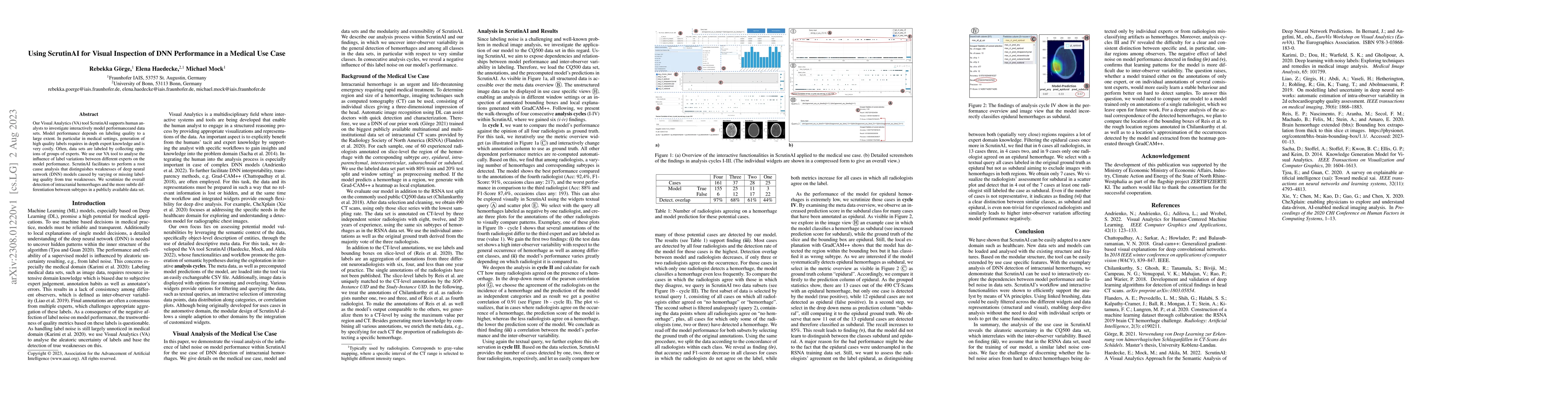 Thumbnail for Using ScrutinAI for Visual Inspection of DNN Performance in a Medical
  Use Case