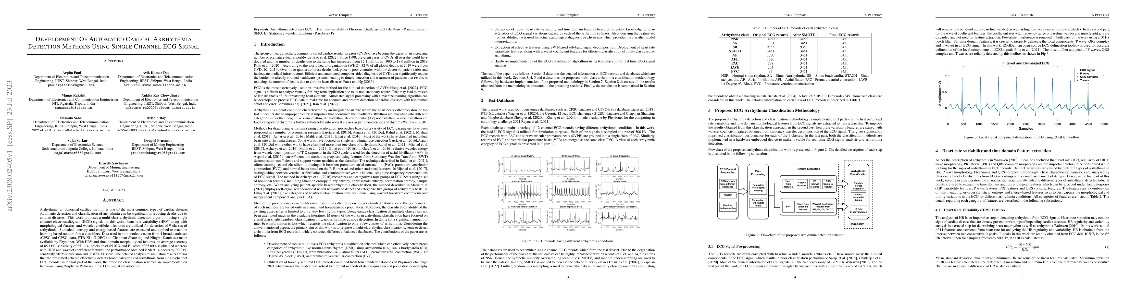 Thumbnail for Development Of Automated Cardiac Arrhythmia Detection Methods Using
  Single Channel ECG Signal