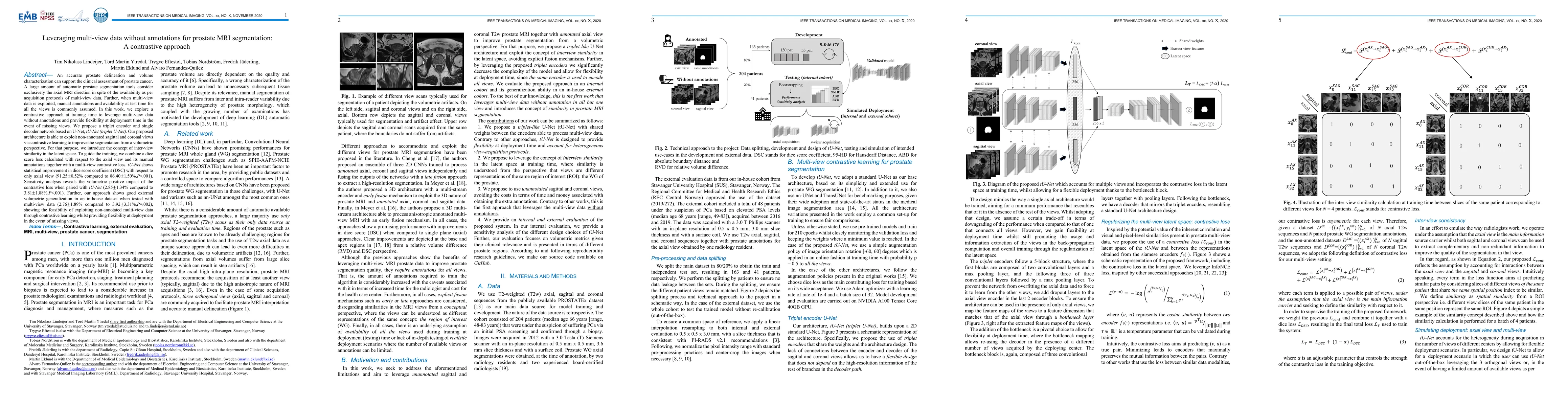 Thumbnail for Leveraging multi-view data without annotations for prostate MRI
  segmentation: A contrastive approach