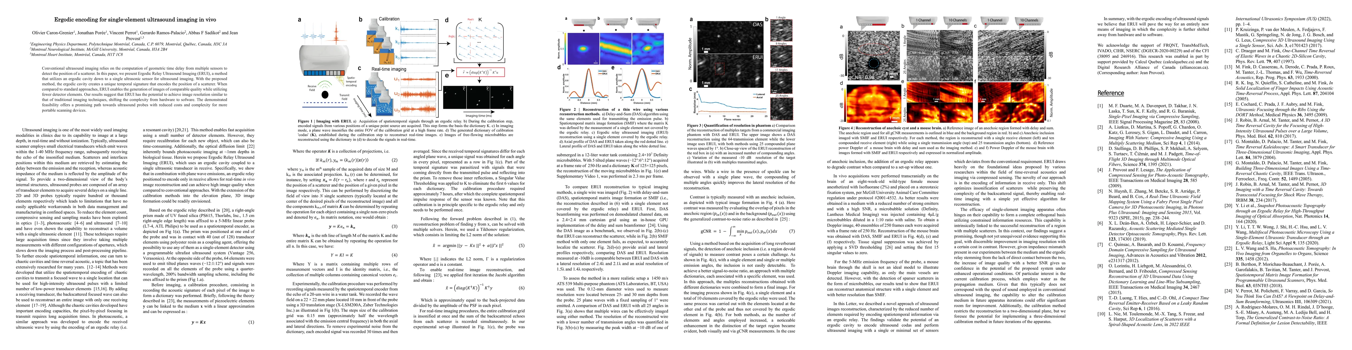 Thumbnail for Ergodic encoding for single-element ultrasound imaging in vivo