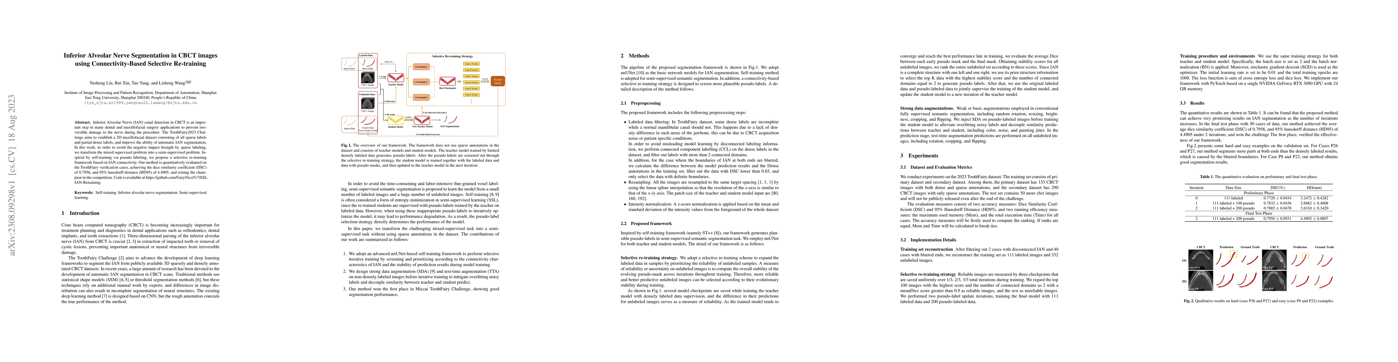 Thumbnail for Inferior Alveolar Nerve Segmentation in CBCT images using
  Connectivity-Based Selective Re-training