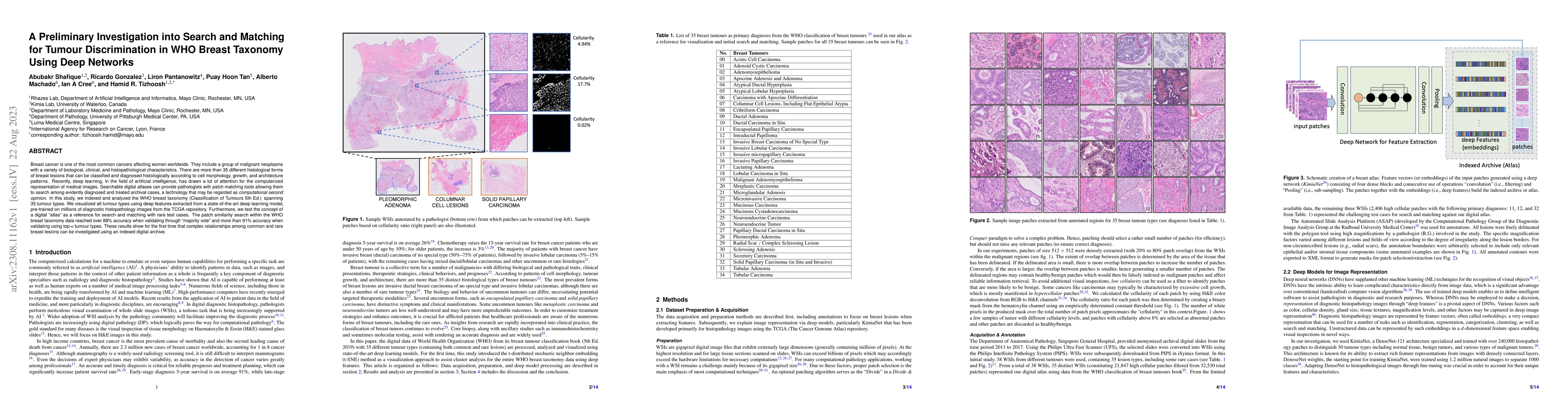 Thumbnail for A Preliminary Investigation into Search and Matching for Tumour
  Discrimination in WHO Breast Taxonomy Using Deep Networks