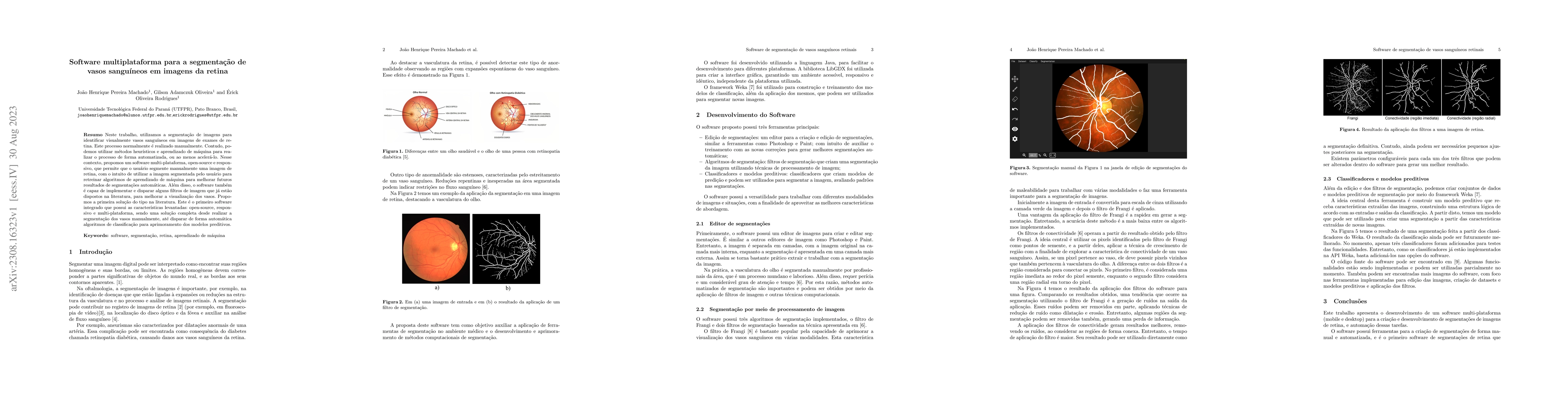 Thumbnail for Software multiplataforma para a segmenta\c{c}\~ao de vasos sangu\'ineos
  em imagens da retina