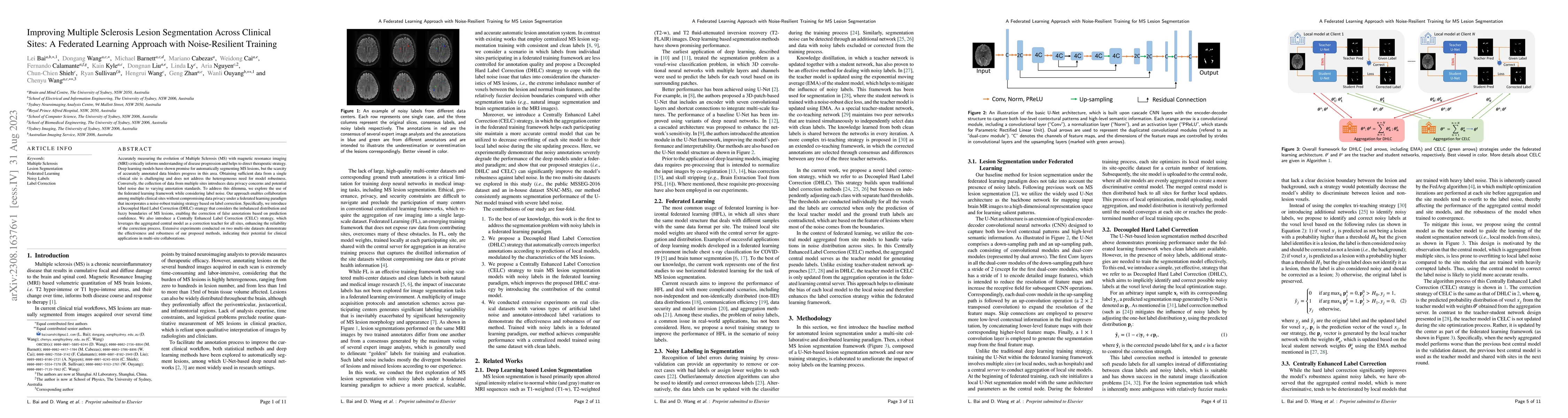 Thumbnail for Improving Multiple Sclerosis Lesion Segmentation Across Clinical Sites:
  A Federated Learning Approach with Noise-Resilient Training