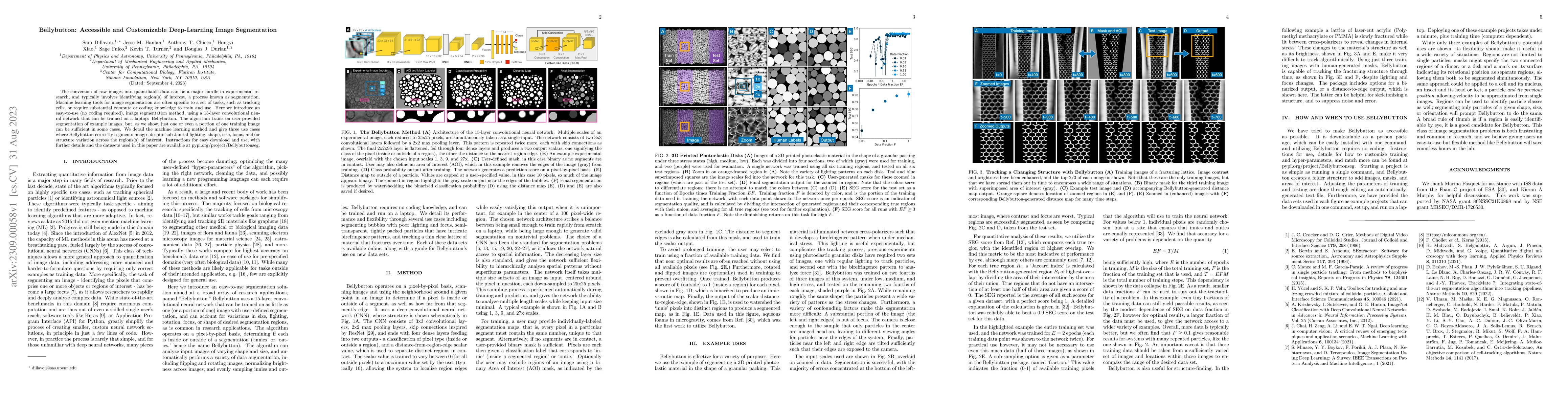 Thumbnail for Bellybutton: Accessible and Customizable Deep-Learning Image
  Segmentation