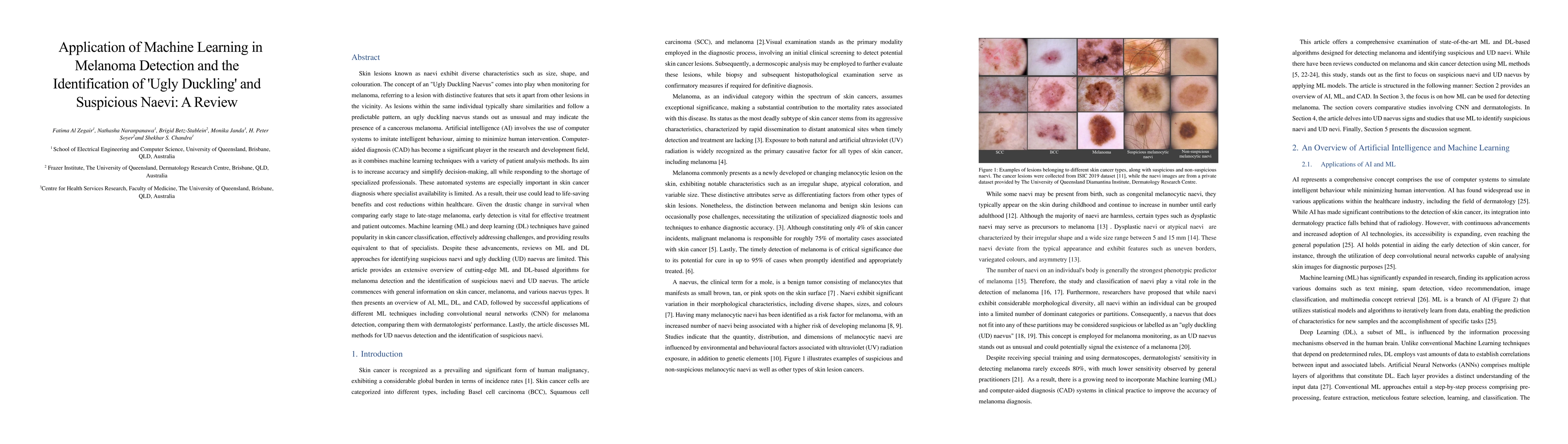 Thumbnail for Application of Machine Learning in Melanoma Detection and the
  Identification of 'Ugly Duckling' and Suspicious Naevi: A Review