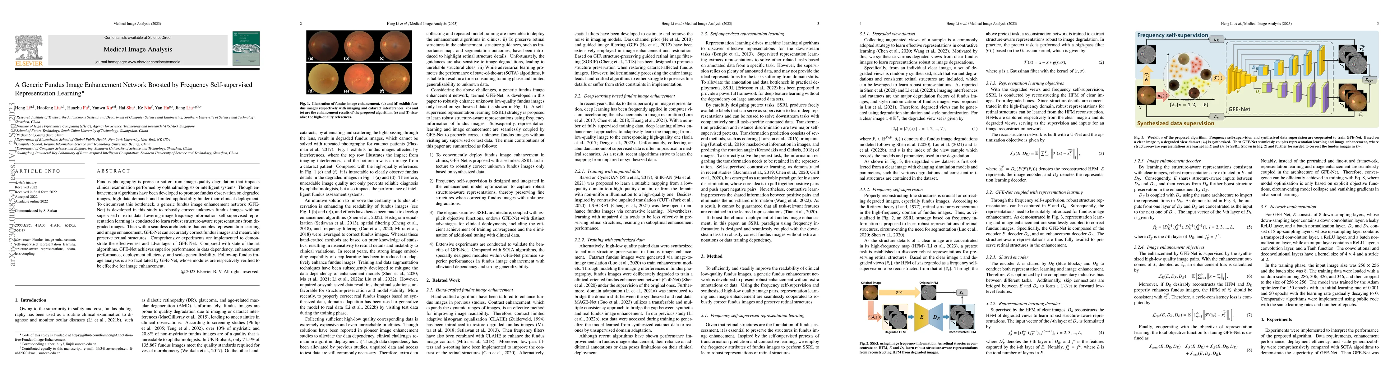 Thumbnail for A Generic Fundus Image Enhancement Network Boosted by Frequency
  Self-supervised Representation Learning