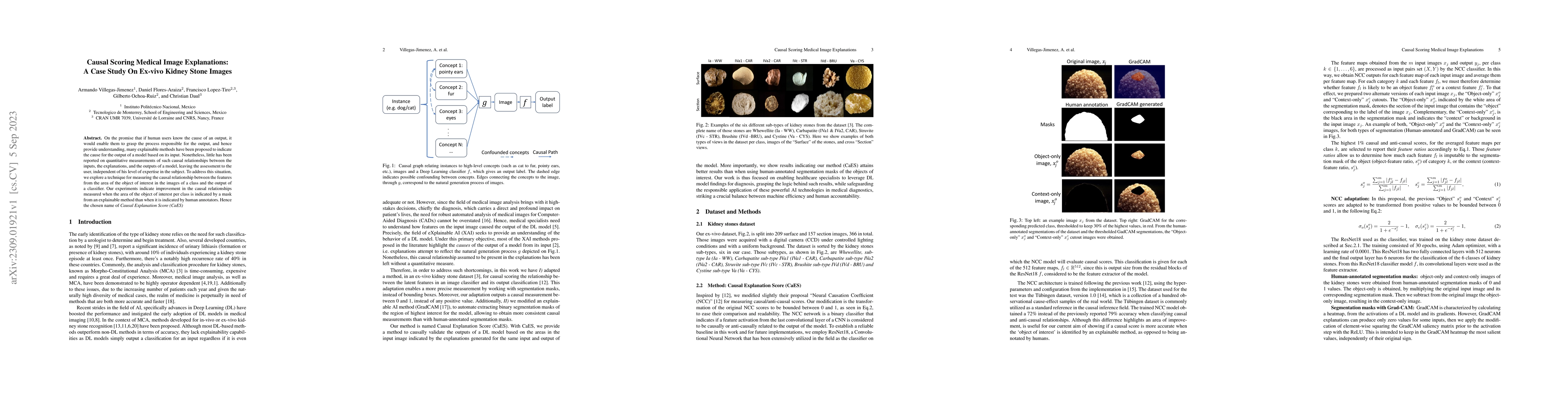 Thumbnail for Causal Scoring Medical Image Explanations: A Case Study On Ex-vivo
  Kidney Stone Images