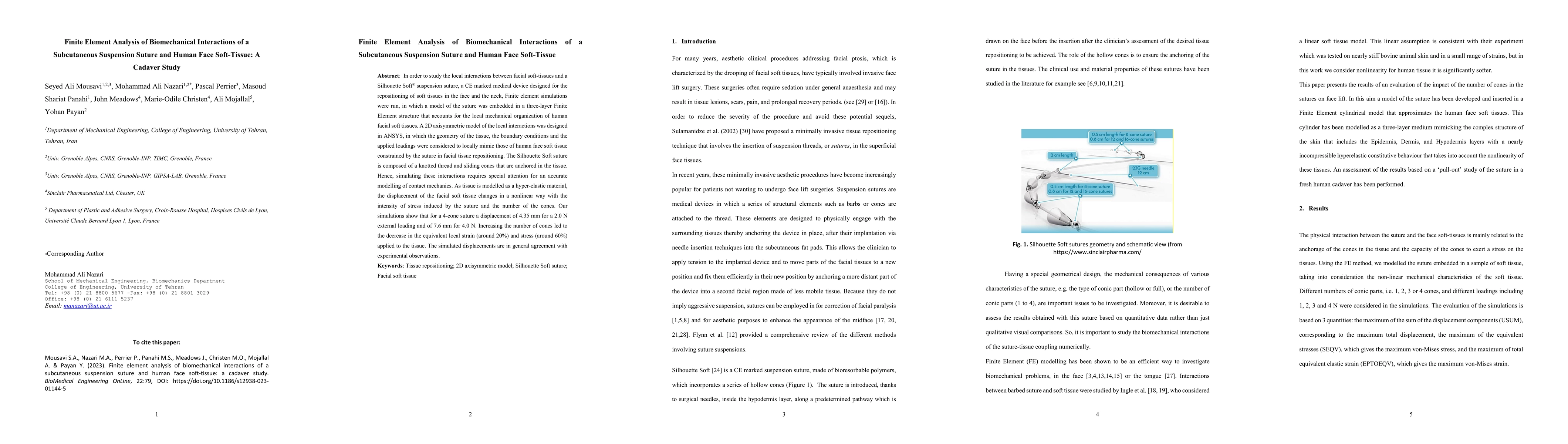 Thumbnail for Finite element analysis of biomechanical interactions of a subcutaneous
  suspension suture and human face soft-tissue: a cadaver study