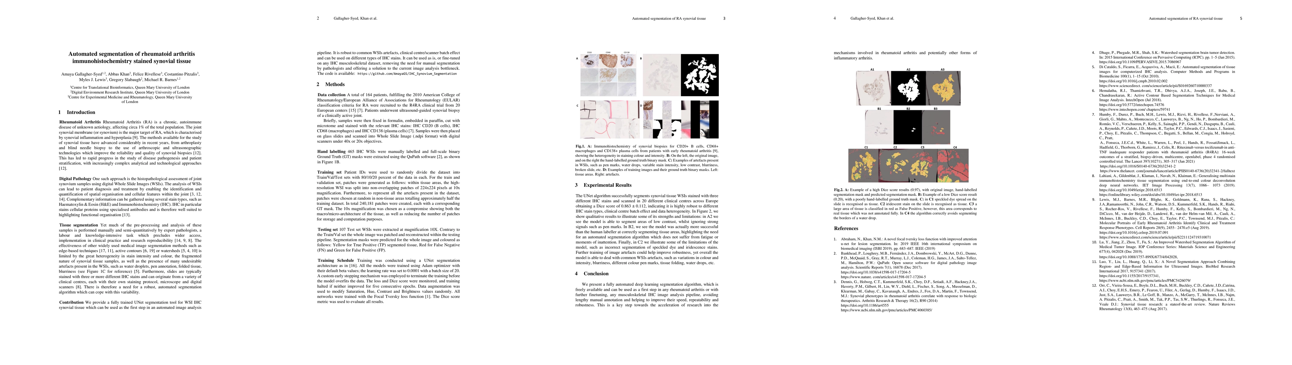 Thumbnail for Automated segmentation of rheumatoid arthritis immunohistochemistry
  stained synovial tissue