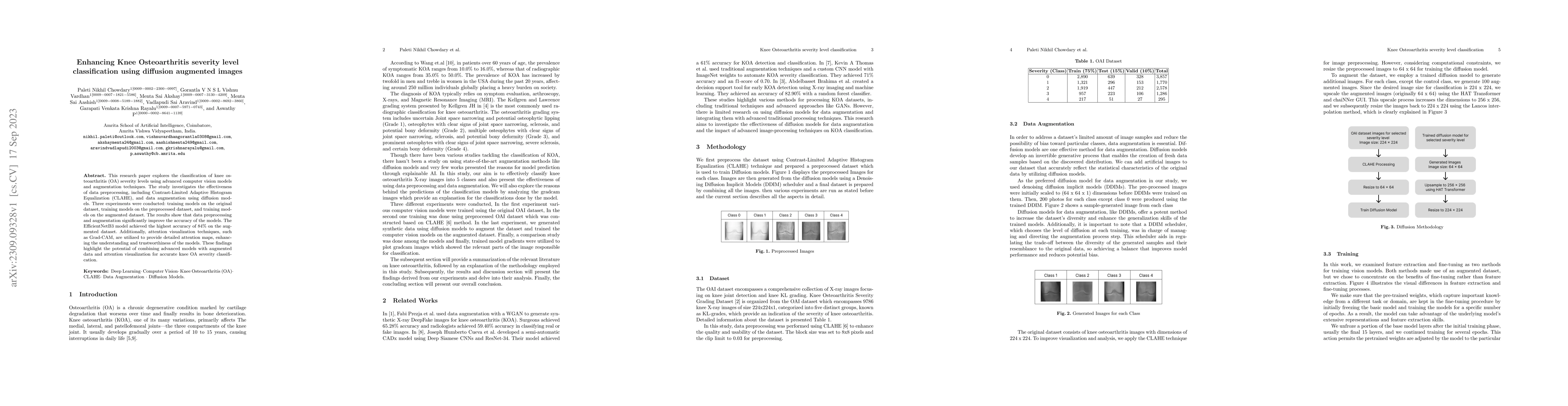 Thumbnail for Enhancing Knee Osteoarthritis severity level classification using
  diffusion augmented images