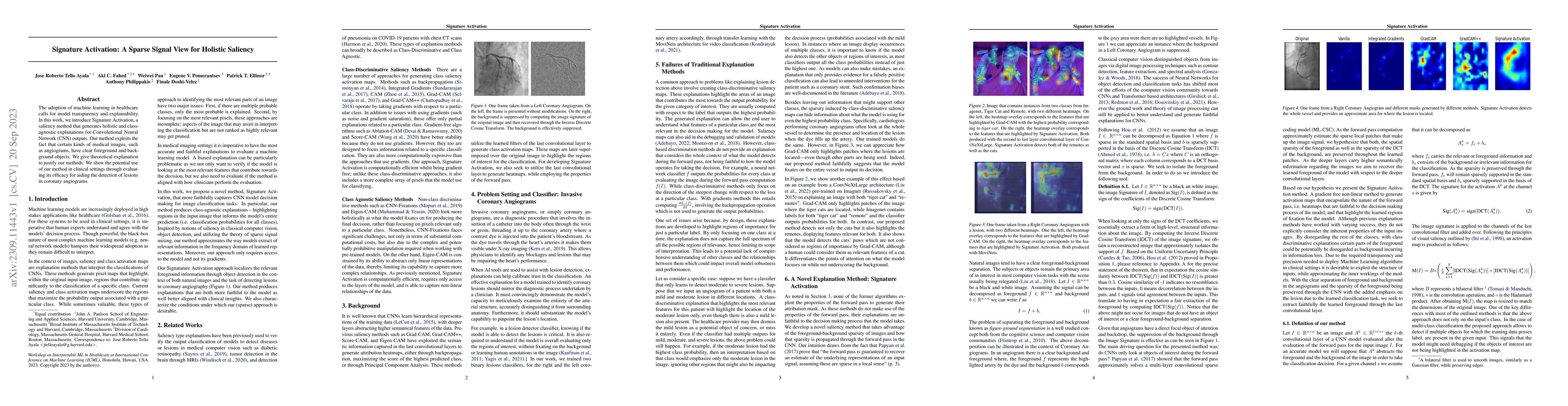 Thumbnail for Signature Activation: A Sparse Signal View for Holistic Saliency