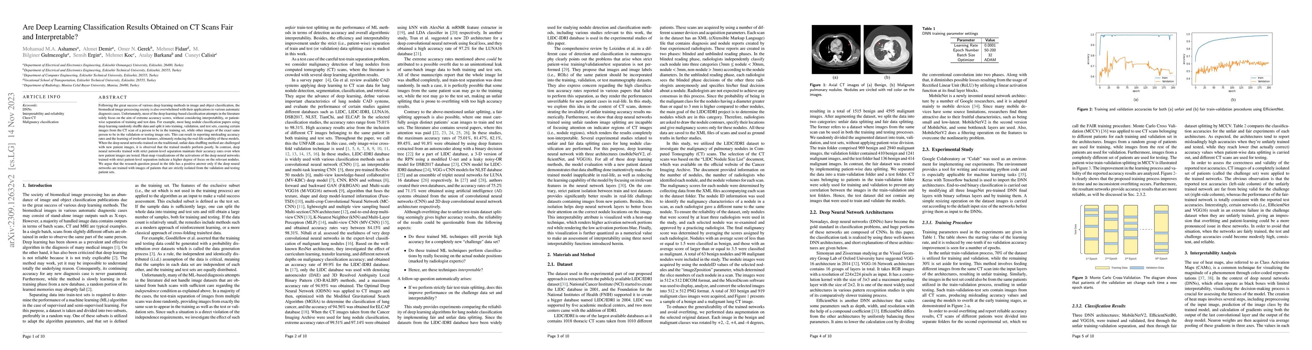 Thumbnail for Are Deep Learning Classification Results Obtained on CT Scans Fair and
  Interpretable?