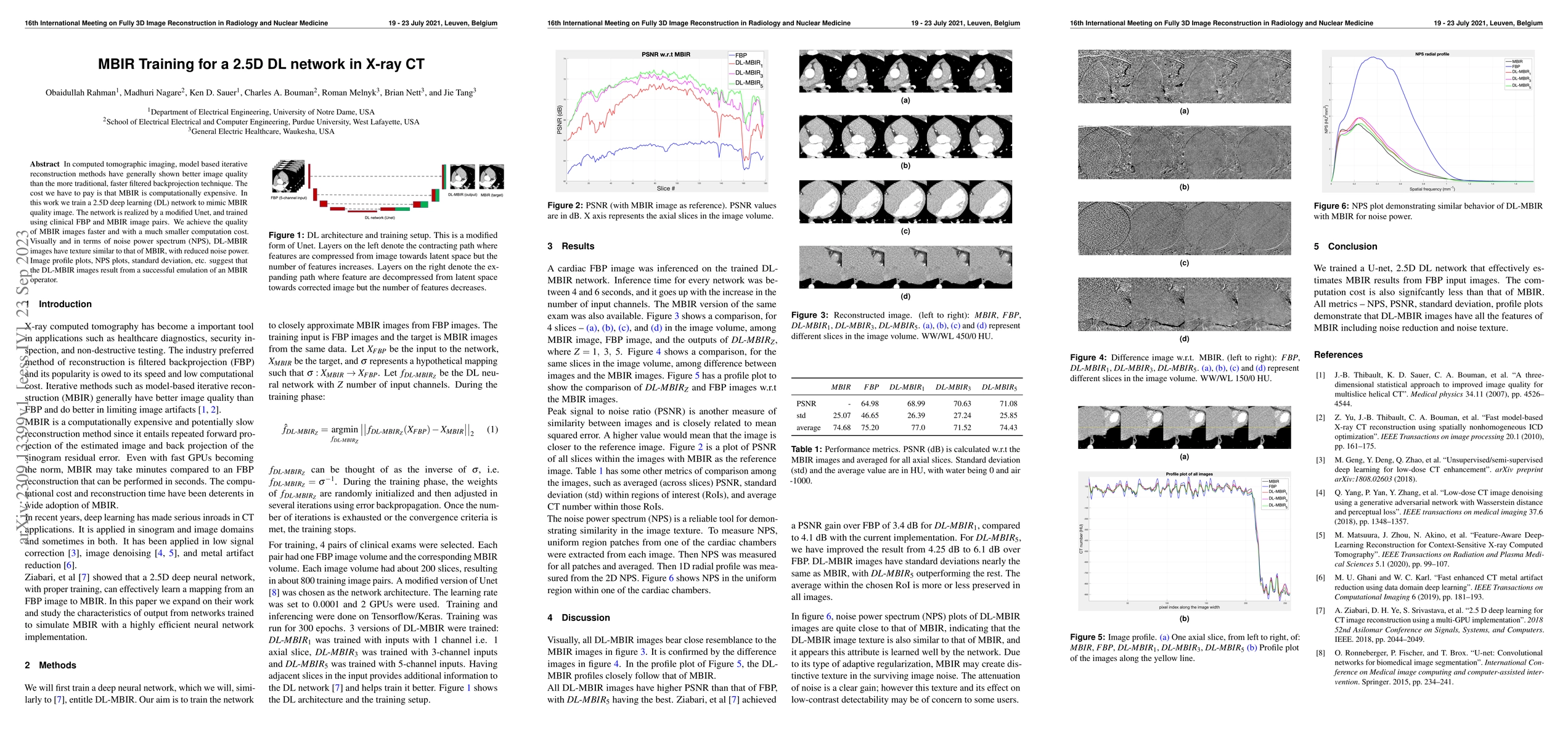 Thumbnail for MBIR Training for a 2.5D DL network in X-ray CT