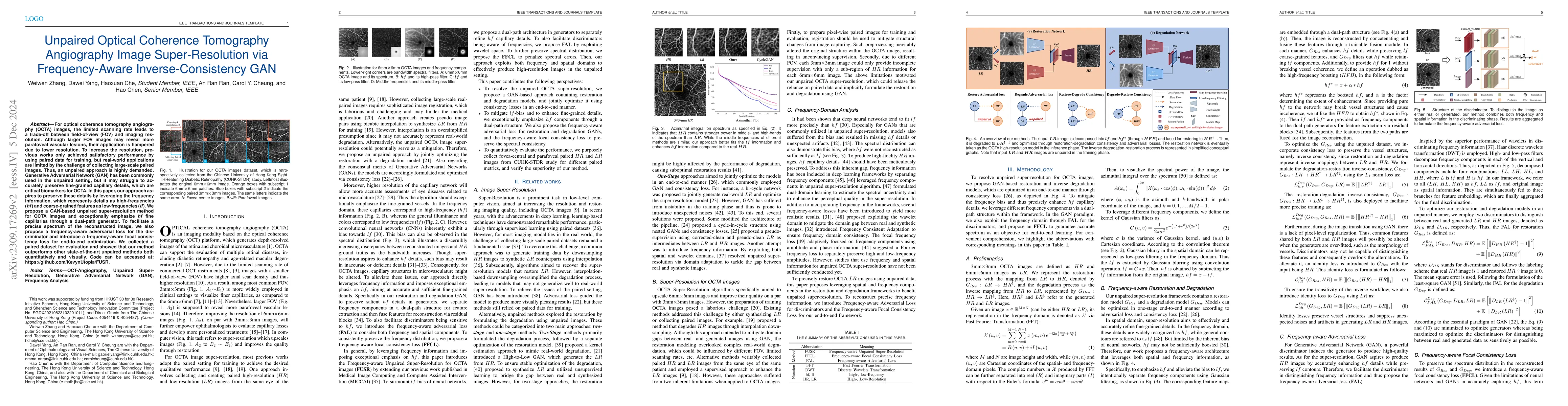 Thumbnail for Unpaired Optical Coherence Tomography Angiography Image Super-Resolution
  via Frequency-Aware Inverse-Consistency GAN