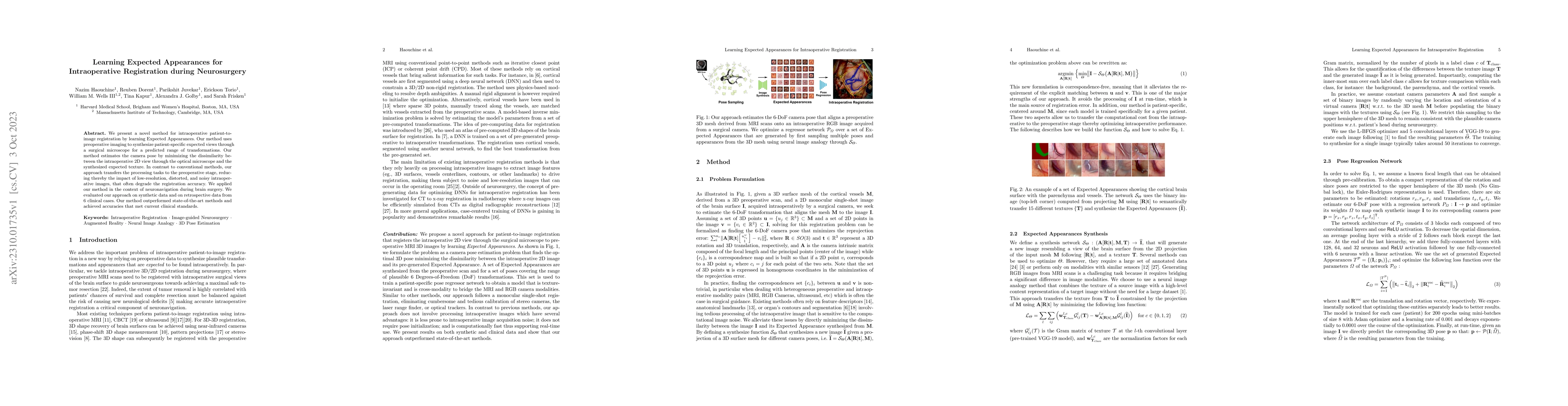 Thumbnail for Learning Expected Appearances for Intraoperative Registration during
  Neurosurgery
