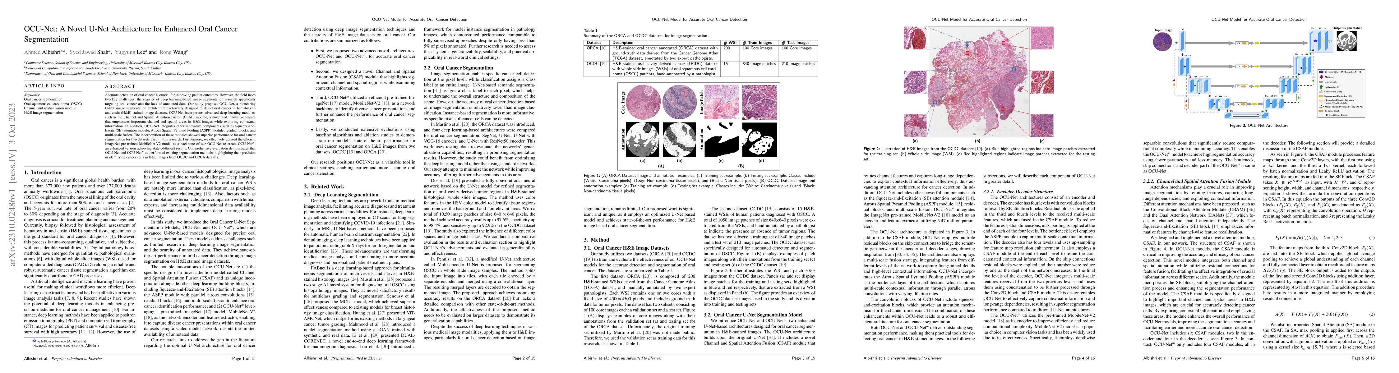 Thumbnail for OCU-Net: A Novel U-Net Architecture for Enhanced Oral Cancer
  Segmentation