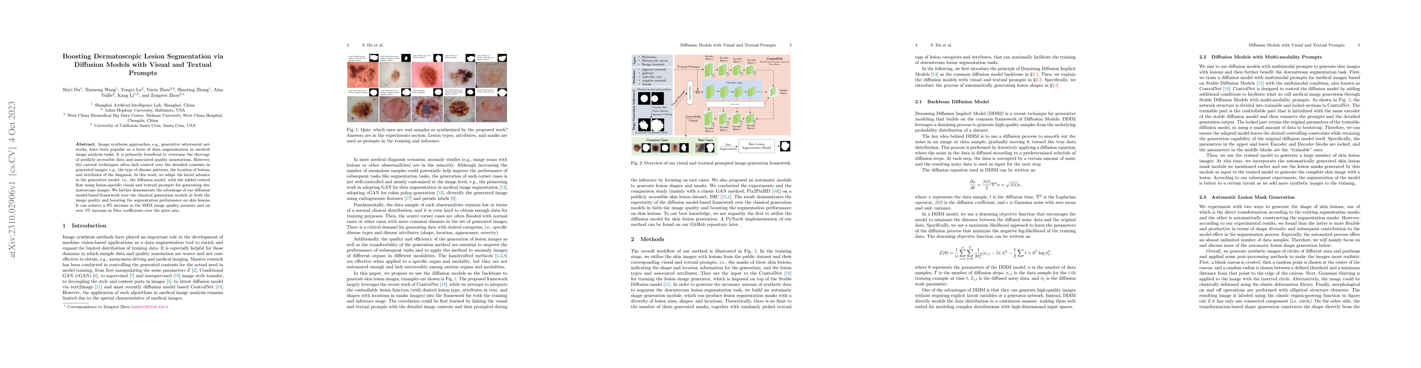 Thumbnail for Boosting Dermatoscopic Lesion Segmentation via Diffusion Models with
  Visual and Textual Prompts