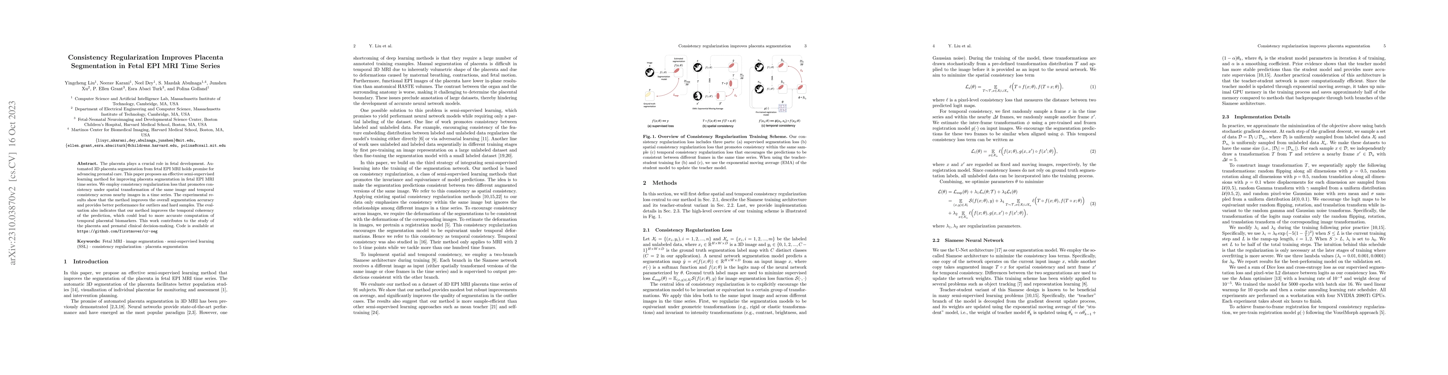 Thumbnail for Consistency Regularization Improves Placenta Segmentation in Fetal EPI
  MRI Time Series