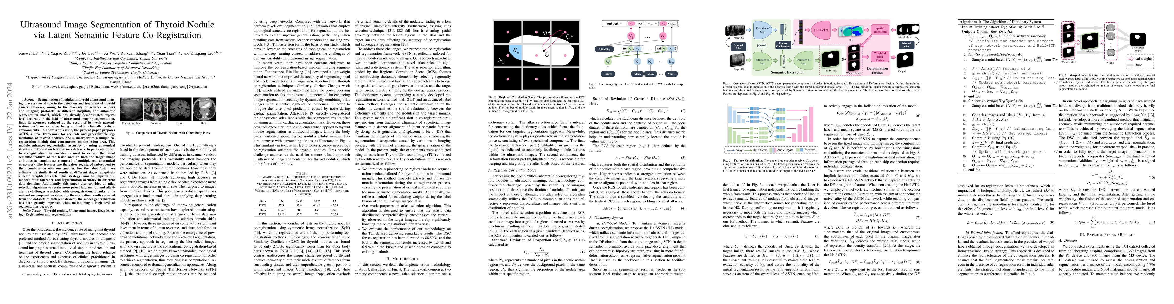 Thumbnail for Ultrasound Image Segmentation of Thyroid Nodule via Latent Semantic
  Feature Co-Registration