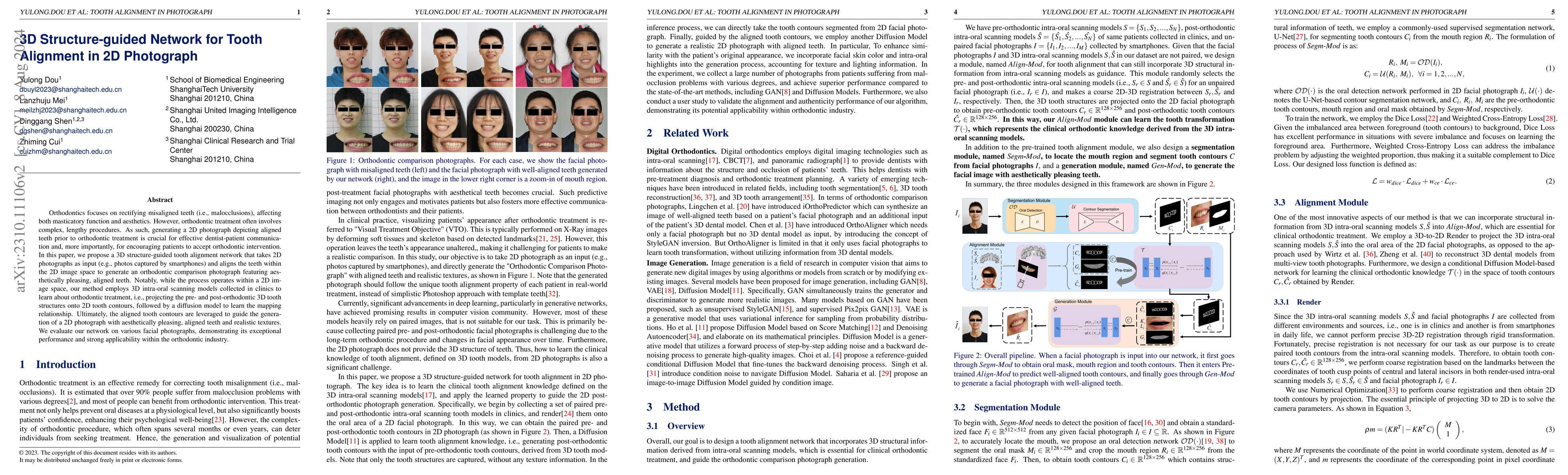 Thumbnail for 3D Structure-guided Network for Tooth Alignment in 2D Photograph