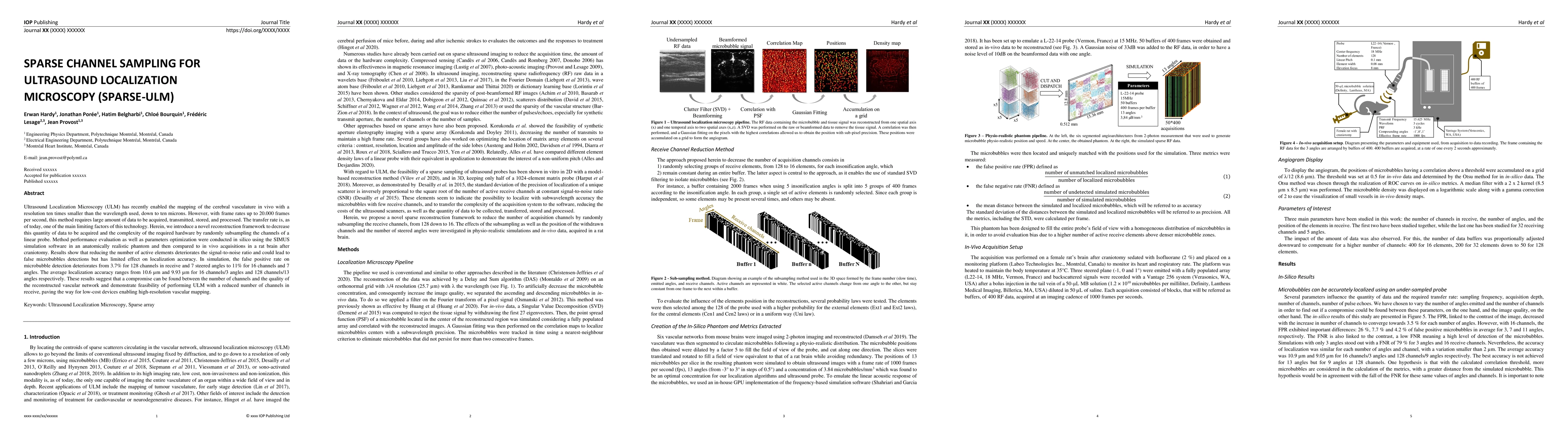 Thumbnail for Sparse channel sampling for ultrasound localization microscopy
  (SPARSE-ULM)