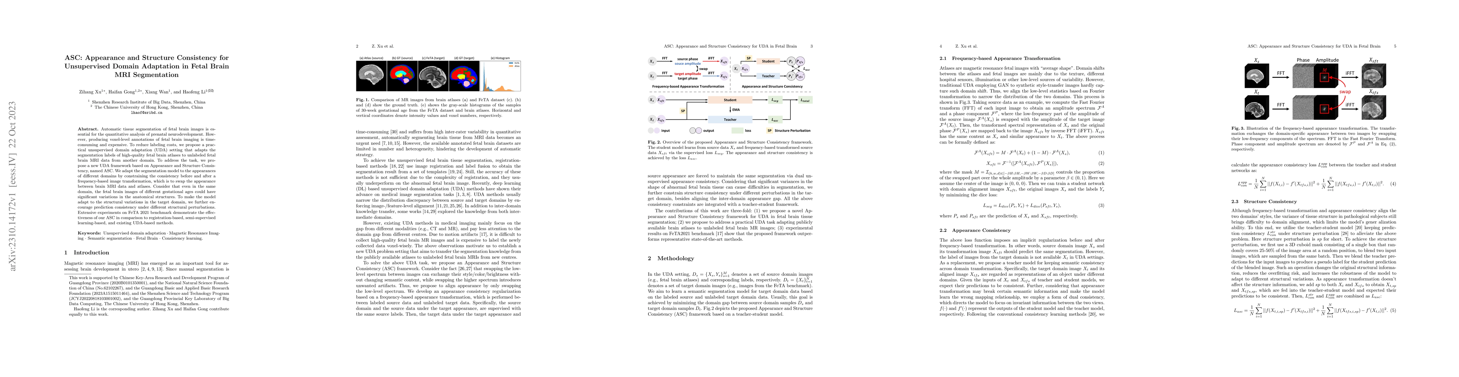Thumbnail for ASC: Appearance and Structure Consistency for Unsupervised Domain
  Adaptation in Fetal Brain MRI Segmentation