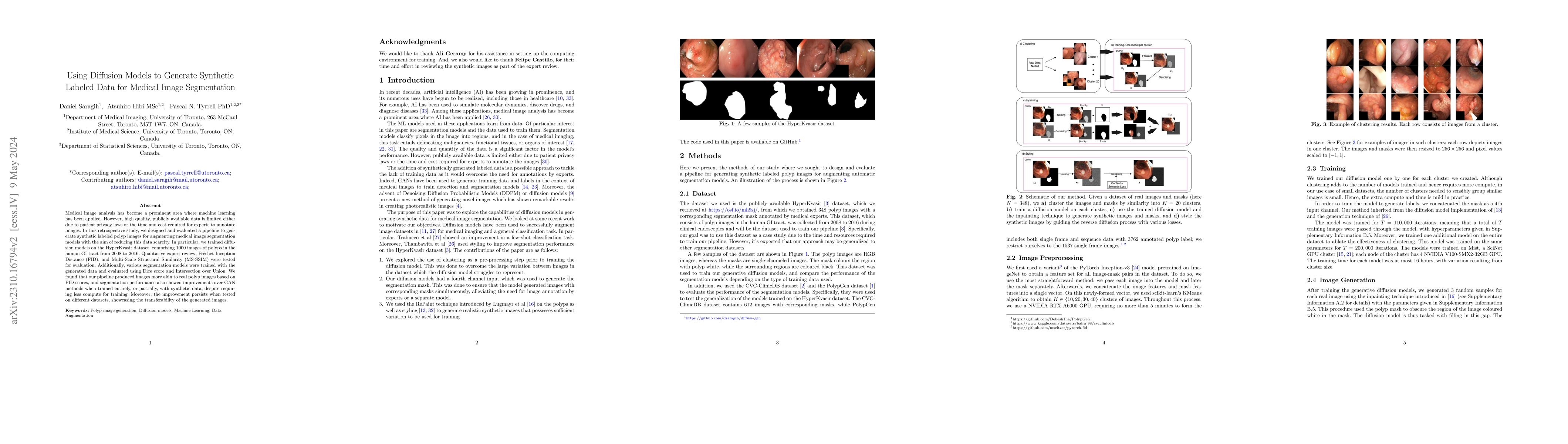 Thumbnail for Using Diffusion Models to Generate Synthetic Labelled Data for Medical
  Image Segmentation